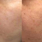 エンビロン　ビフォーアフター