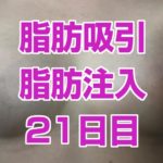 お腹の脂肪吸引&脂肪注入21日目（画像＆比較画像あり）